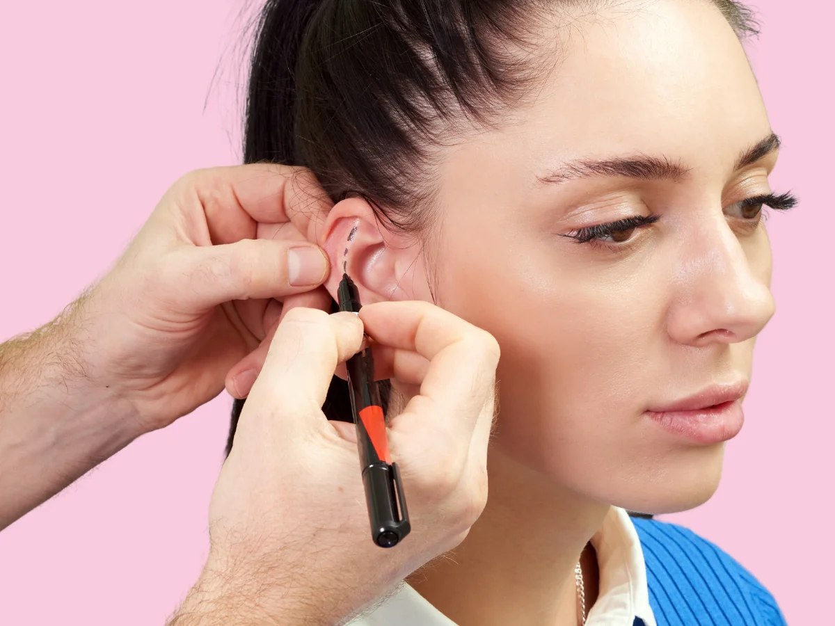 Doctor carefully marking a woman's ear in preparation for otoplasty procedure in Kerala