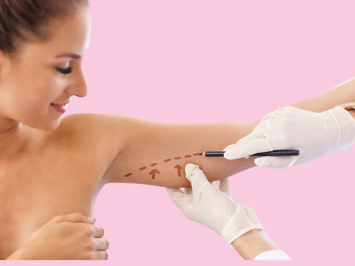 Thigh and arm lift in BMH Calicut